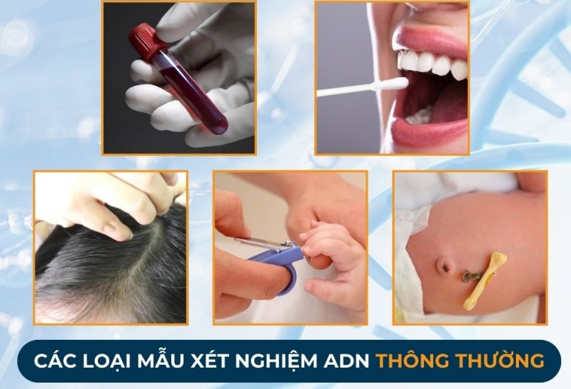 mau xet nghiem adn chinhhxac